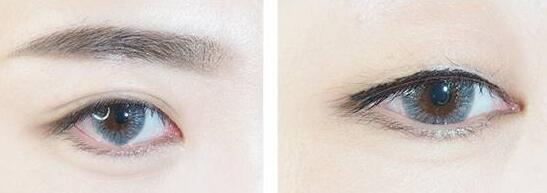 1582375952292566.jpg 1.jpg