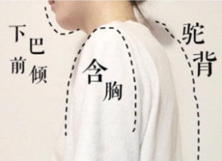 南寧美容學(xué)校：堅(jiān)持一個(gè)月，駝背變直背