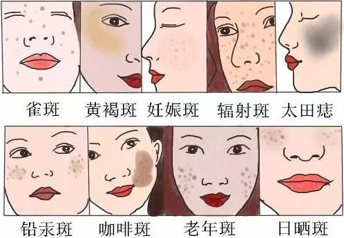 南寧美容學(xué)校：這7個日常習(xí)慣給你一臉斑