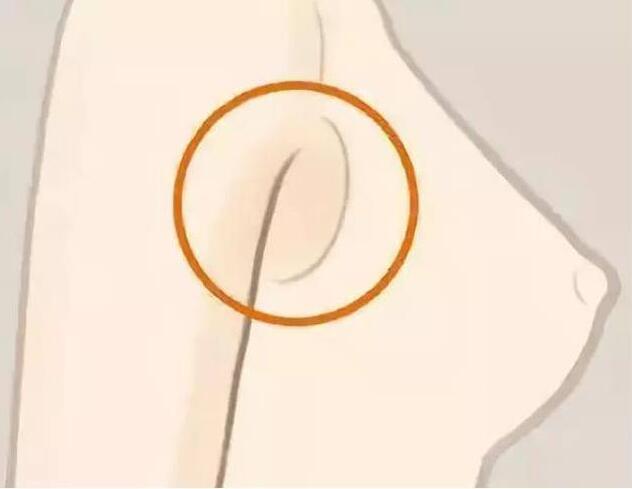 減副乳，瘦手臂一招就解決！