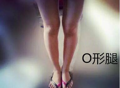 糾正你的腿型！