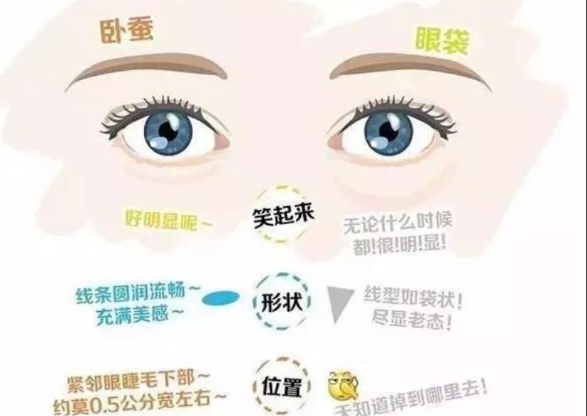 眼袋還是臥蠶，快來學辨別的方法
