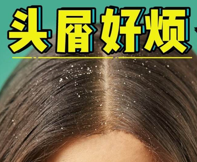 南寧正規(guī)美發(fā)培訓學校分享：冬天如何減少頭屑過多？