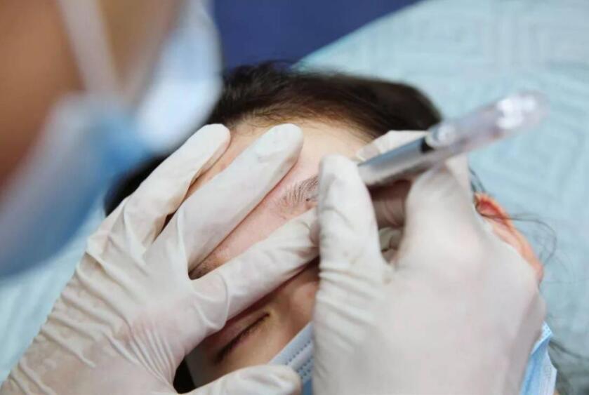 紋繡遇到容易出血的皮膚怎么辦？南寧專業(yè)紋繡培訓(xùn)教你