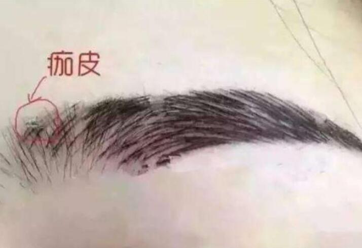 紋眉結(jié)痂時要注意什么？麗紋竹繡學校教你