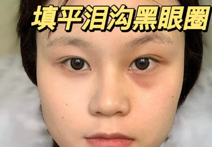 填平淚溝黑眼圈教程，廣西南寧化妝學(xué)校分享