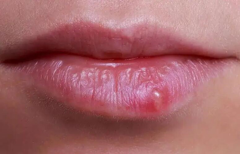 紋唇后起泡怎么辦？南寧紋唇培訓(xùn)學(xué)校教你方法