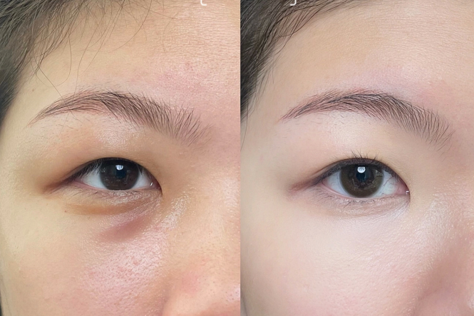 新手遮瑕教程，南寧化妝課程基礎(chǔ)分享