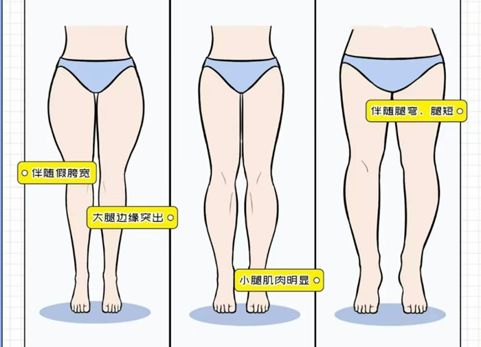 腿粗女生穿搭攻略，廣西彩妝造型搭配