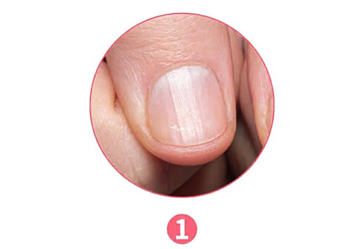 女生氣血不足六大表現(xiàn)，南寧美容養(yǎng)生資訊報道