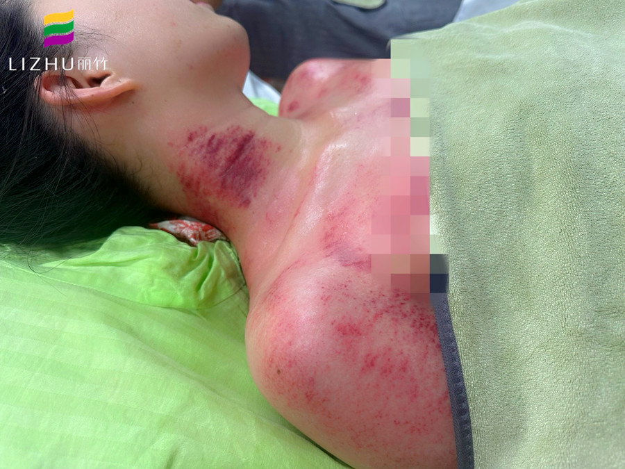 廣西學(xué)刮痧培訓(xùn)班 | 廣西學(xué)刮痧學(xué)費(fèi)多少？