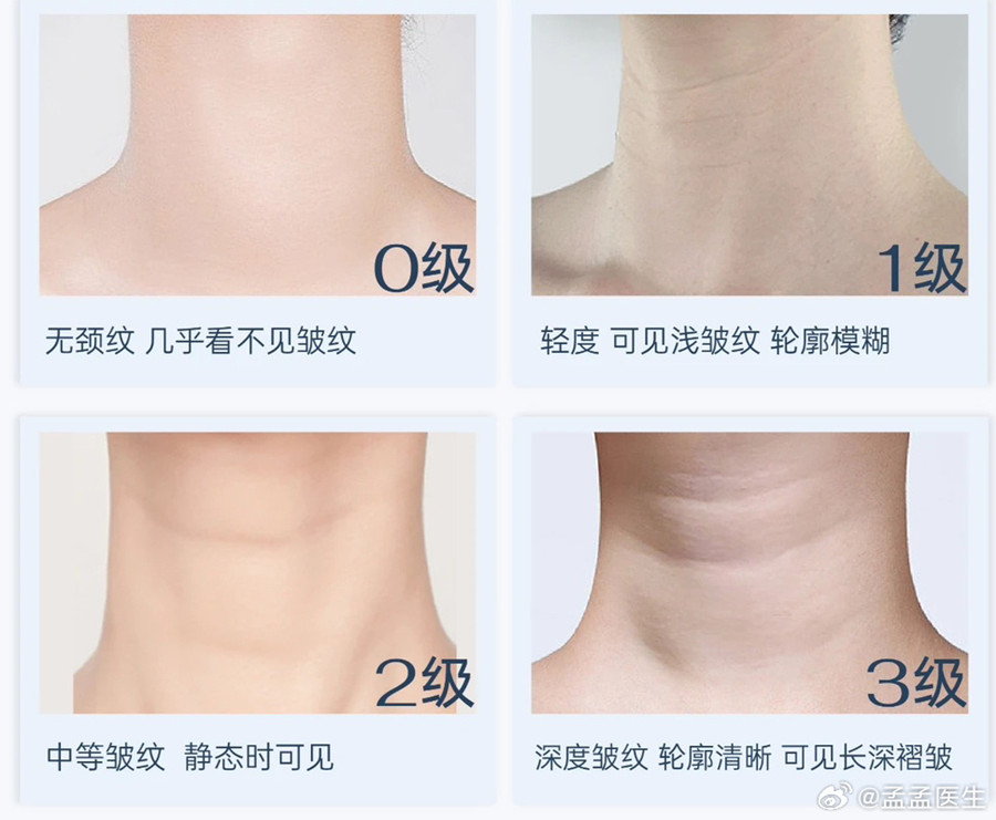 如何緩解頸紋？南寧美體美容管理培訓(xùn)