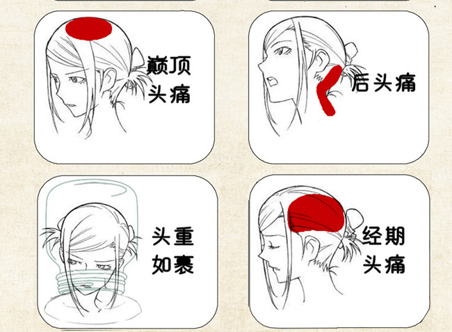不同頭痛類型經(jīng)絡(luò)護理方法，廣西中醫(yī)美容培訓