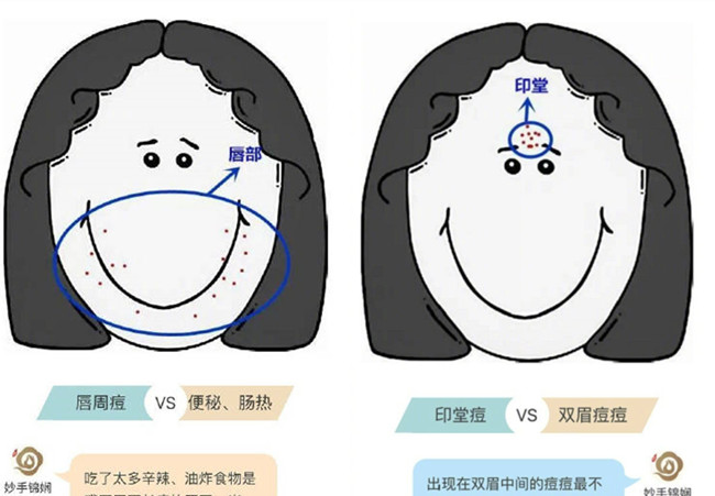 南寧皮膚管理學(xué)校排名：臉上不同部位長痘的原因及改善方法