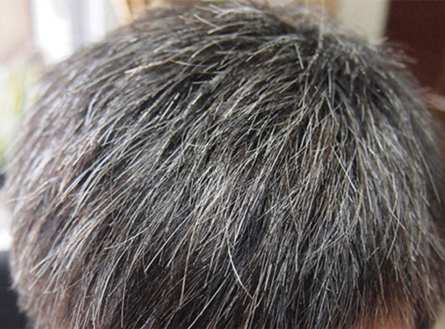 南寧美發(fā)基礎教學：為什么會長白頭發(fā)？